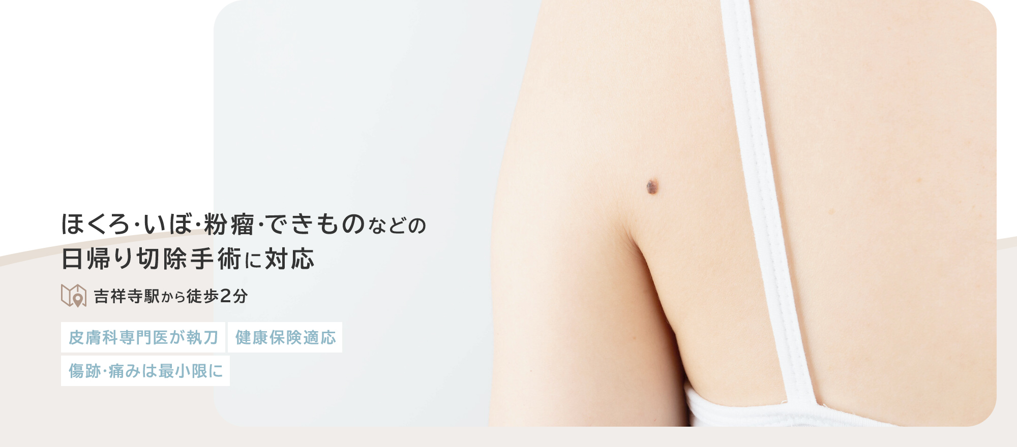 ほくろ・いぼ・粉瘤・できものなどの日帰り切除手術に対応 吉祥寺駅から徒歩2分 皮膚科専門医が執刀 健康保険適応 傷跡・痛みは最小限に