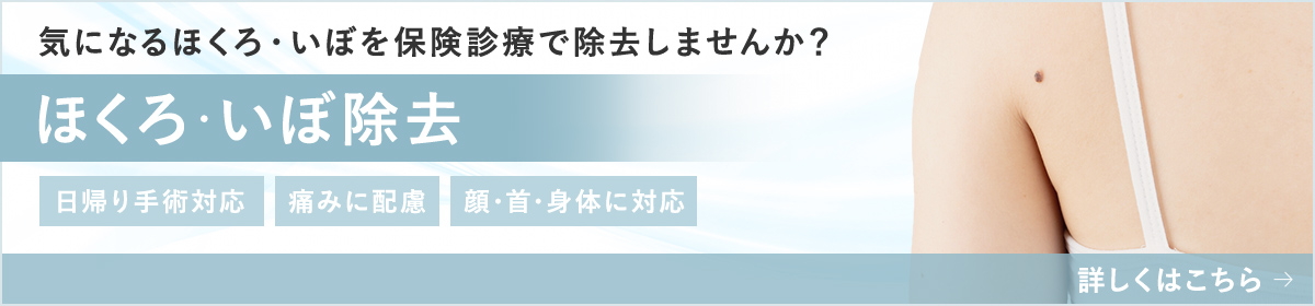 ほくろ・いぼ除去