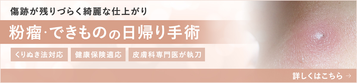 粉瘤・できものの日帰り手術