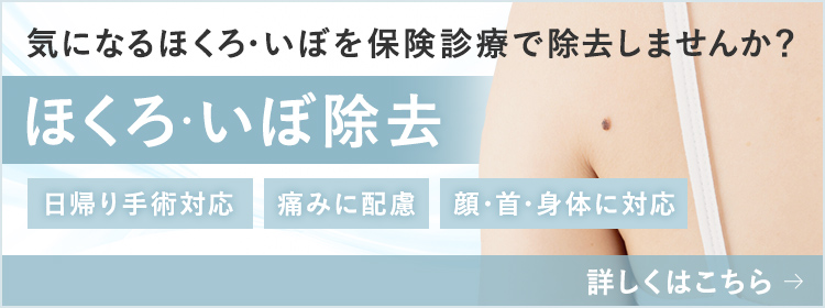 ほくろ・いぼ除去