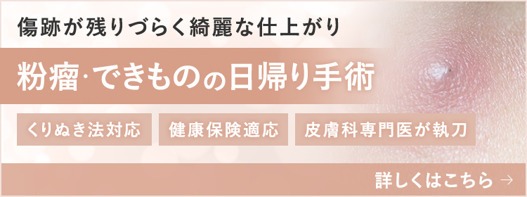 粉瘤・できものの日帰り手術