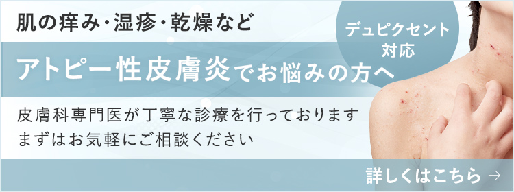 アトピー性皮膚炎でお悩みの方へ