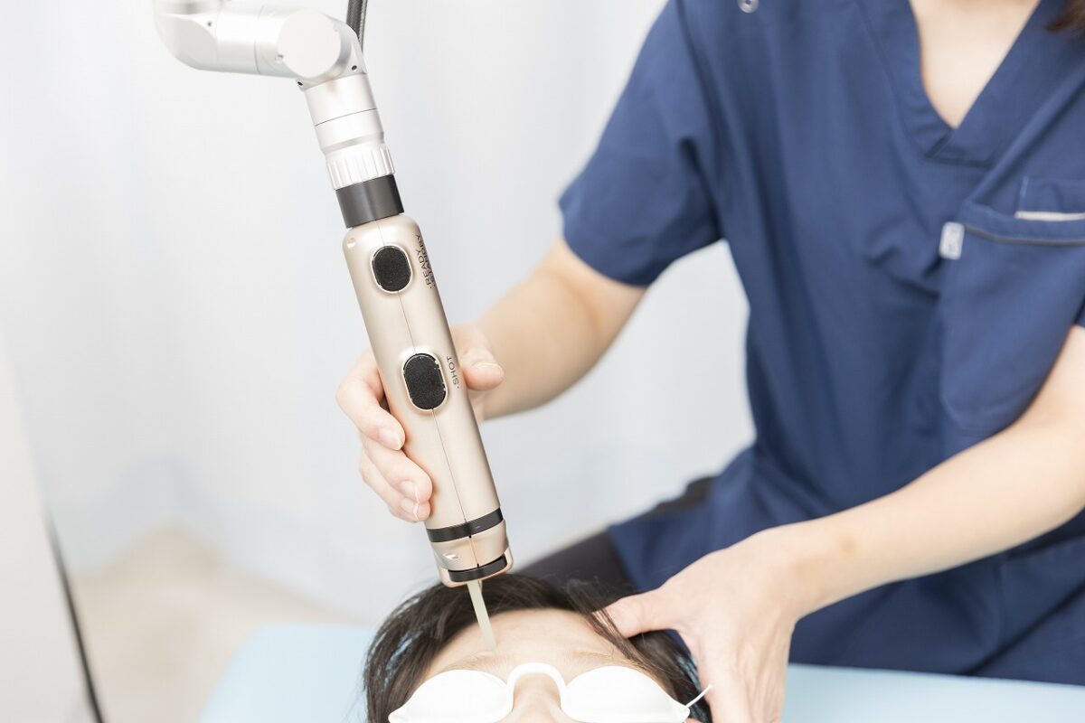 スポット照射（シミ取り）